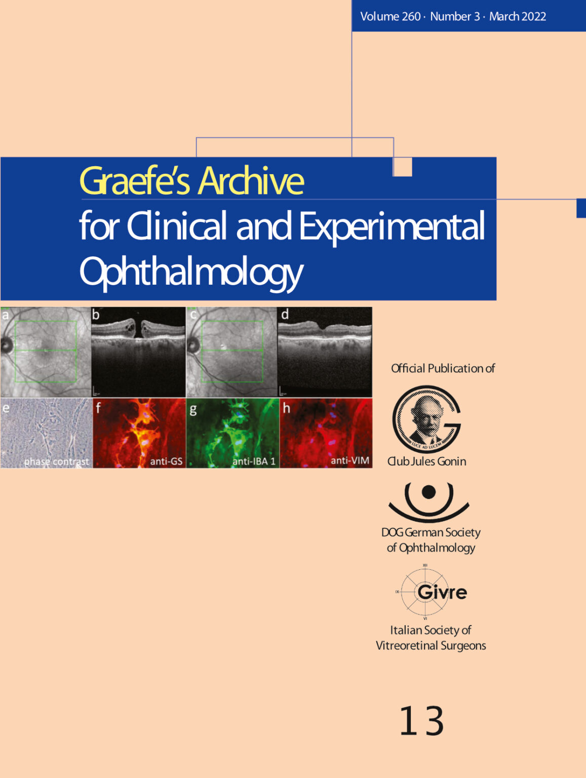 graefe's archive for clinical and experimental ophthalmology